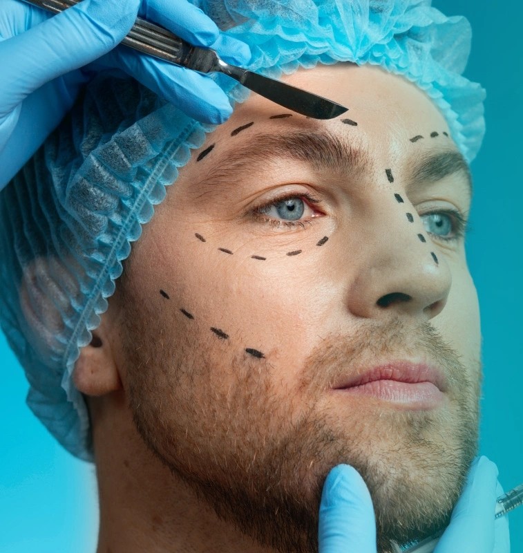 Squint-Specialist-–-Dr.-Ola-Alsaed