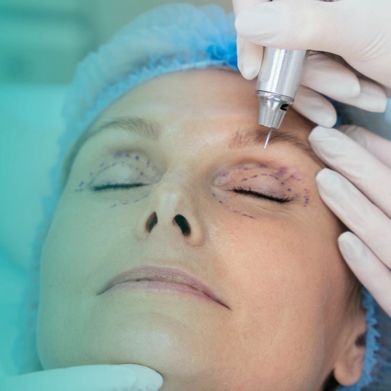 What-is-Pterygium